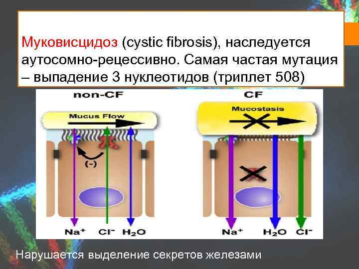 Муковисцидоз (cystic fibrosis), наследуется аутосомно-рецессивно. Самая частая мутация – выпадение 3 нуклеотидов (триплет 508)