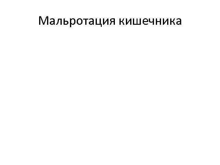 Мальротация кишечника 