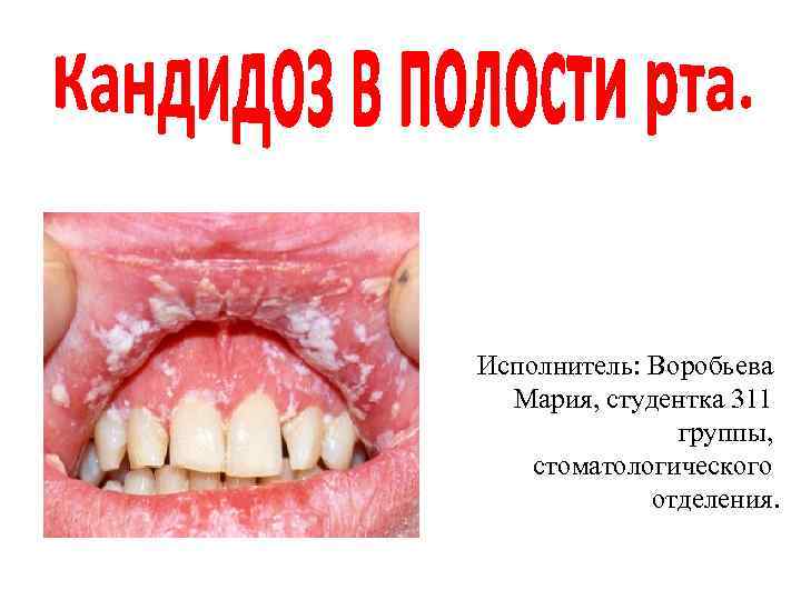 Исполнитель: Воробьева Мария, студентка 311 группы, стоматологического отделения. 