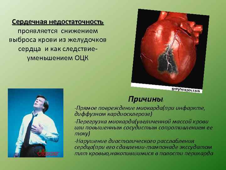 Сердечная недостаточность проявляется снижением выброса крови из желудочков сердца и как следствие уменьшением ОЦК