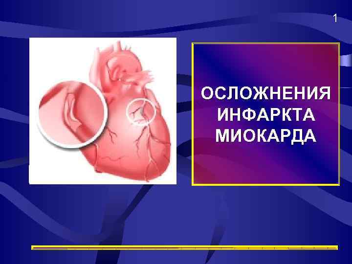 1 ОСЛОЖНЕНИЯ ИНФАРКТА МИОКАРДА 