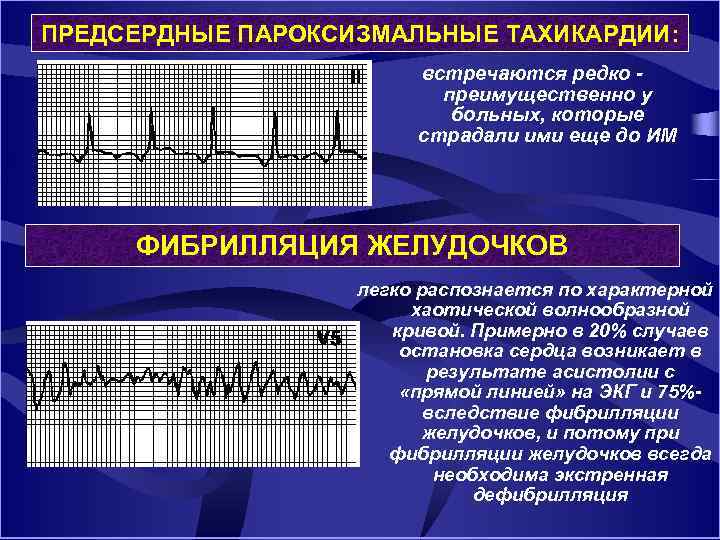 ПРЕДСЕРДНЫЕ ПАРОКСИЗМАЛЬНЫЕ ТАХИКАРДИИ: встречаются редко преимущественно у больных, которые страдали ими еще до ИМ