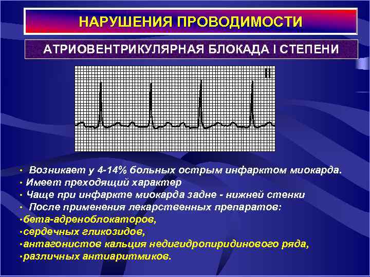 НАРУШЕНИЯ ПРОВОДИМОСТИ АТРИОВЕНТРИКУЛЯРНАЯ БЛОКАДА I СТЕПЕНИ • Возникает у 4 14% больных острым инфарктом