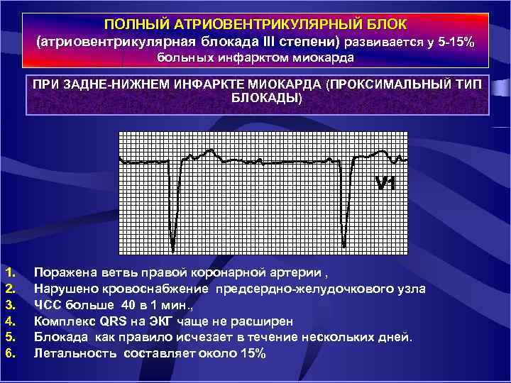 ПОЛНЫЙ АТРИОВЕНТРИКУЛЯРНЫЙ БЛОК (атриовентрикулярная блокада III степени) развивается у 5 15% больных инфарктом миокарда