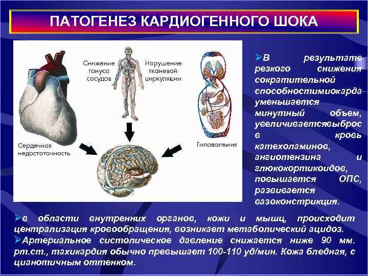 ПАТОГЕНЕЗ КАРДИОГЕННОГО ШОКА ØВ результате резкого снижения сократительной способности иокарда м уменьшается минутный объем,