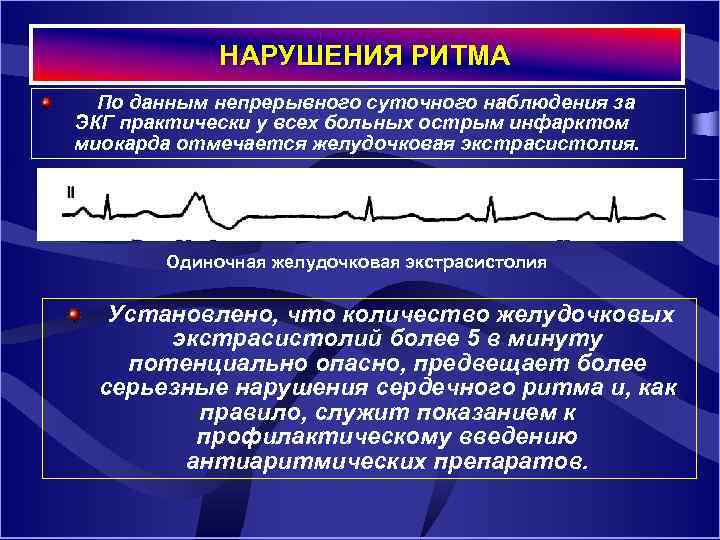  НАРУШЕНИЯ РИТМА По данным непрерывного суточного наблюдения за ЭКГ практически у всех больных