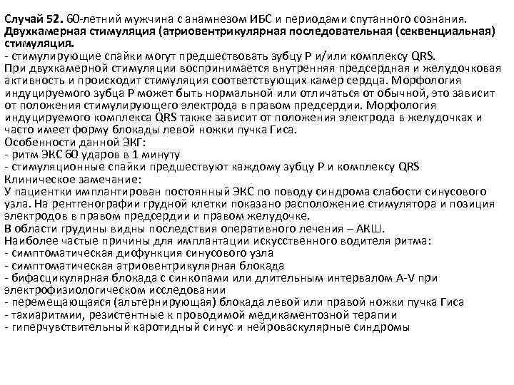 Случай 52. 60 -летний мужчина с анамнезом ИБС и периодами спутанного сознания. Двухкамерная стимуляция