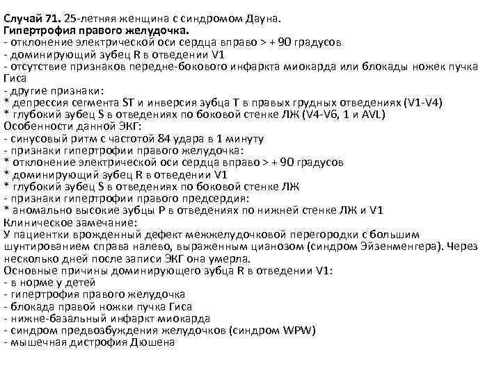 Случай 71. 25 -летняя женщина с синдромом Дауна. Гипертрофия правого желудочка. - отклонение электрической