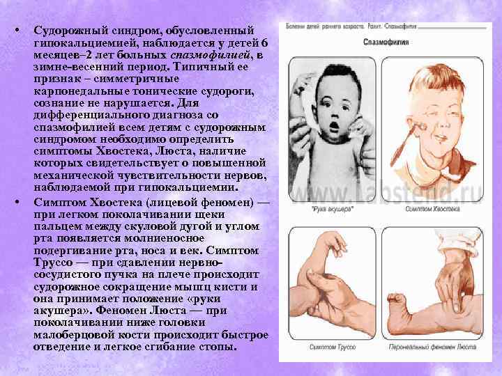 Признаки эпилепсии до года