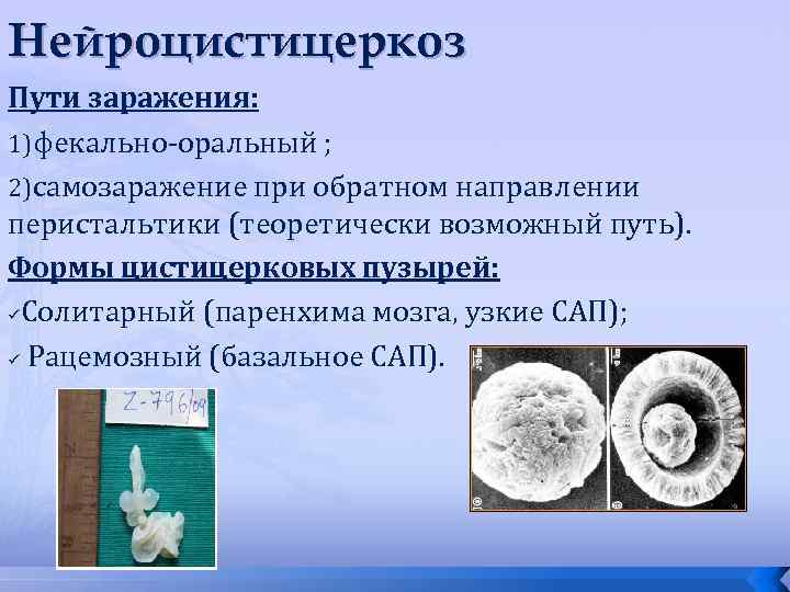 Нейроцистицеркоз Пути заражения: 1)фекально-оральный ; 2)самозаражение при обратном направлении перистальтики (теоретически возможный путь). Формы