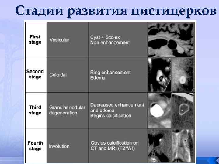 Стадии развития цистицерков 