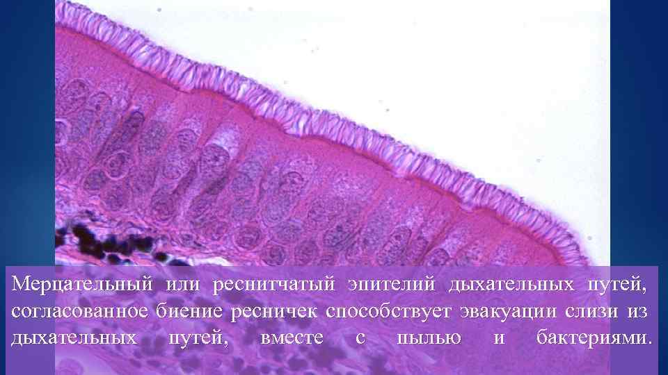 Мерцательный или реснитчатый эпителий дыхательных путей, согласованное биение ресничек способствует эвакуации слизи из дыхательных
