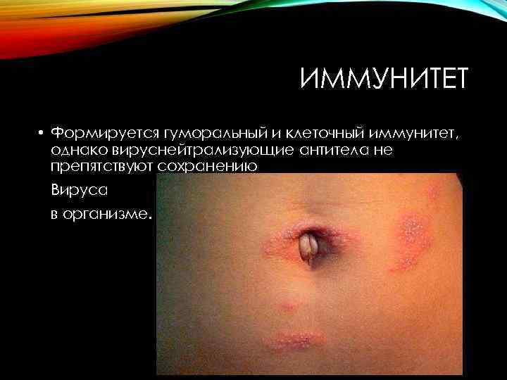 ИММУНИТЕТ • Формируется гуморальный и клеточный иммунитет, однако вируснейтрализующие антитела не препятствуют сохранению Вируса
