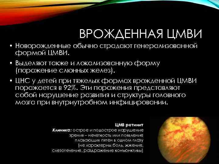 ВРОЖДЕННАЯ ЦМВИ • Новорожденные обычно страдают генерализованной формой ЦМВИ. • Выделяют также и локализованную