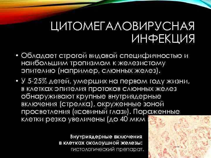 ЦИТОМЕГАЛОВИРУСНАЯ ИНФЕКЦИЯ • Обладает строгой видовой специфичностью и наибольшим тропизмом к железистому эпителию (например,