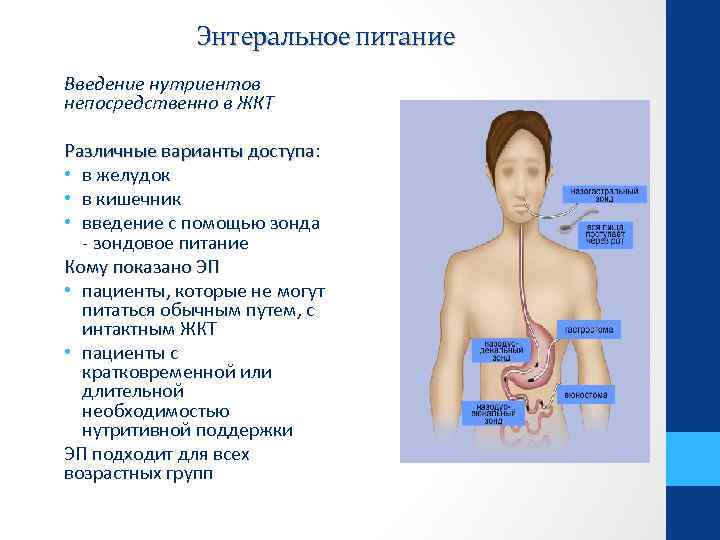 Энтеральное питание Введение нутриентов непосредственно в ЖКТ Различные варианты доступа: Различные варианты доступа •