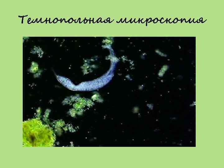 Темнопольная микроскопия 