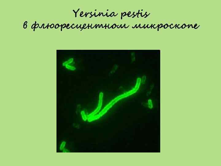 Yersinia pestis в флюоресцентном микроскопе 
