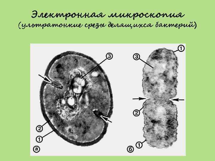 Электронная микроскопия (ультратонкие срезы делящихся бактерий) 
