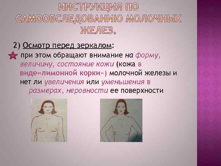 2) Осмотр перед зеркалом: при этом обращают внимание на форму, величину, состояние кожи (кожа