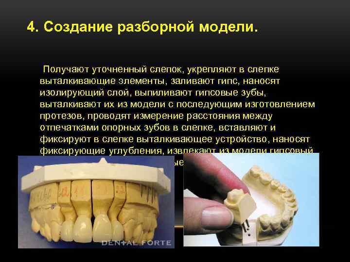 4. Создание разборной модели. Получают уточненный слепок, укрепляют в слепке выталкивающие элементы, заливают гипс,