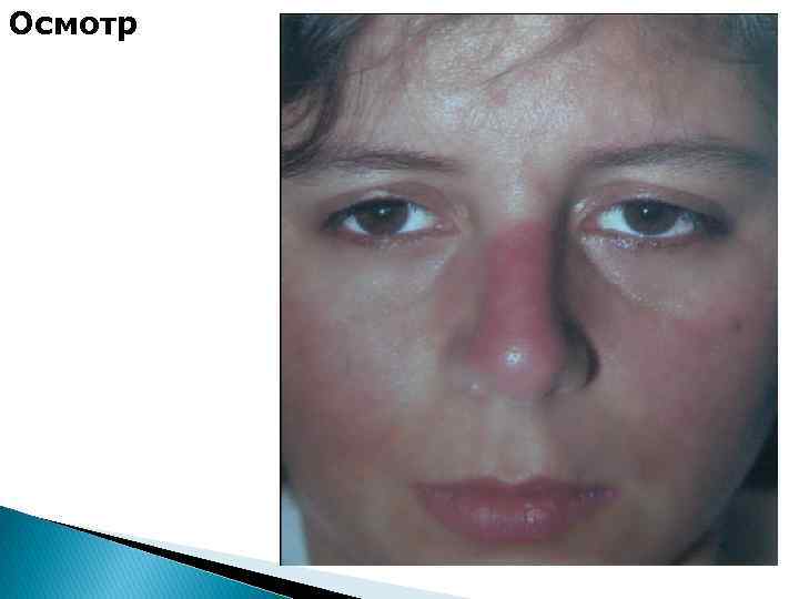 Осмотр 