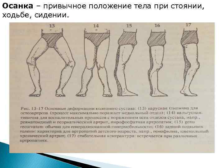 Привычное положение тела. Положение тела при ходьбе. Правильная поза при стоянии сидении ходьбе. Правильное положение тела при ходьбе. Положение тела при ходьбе, стоянии.