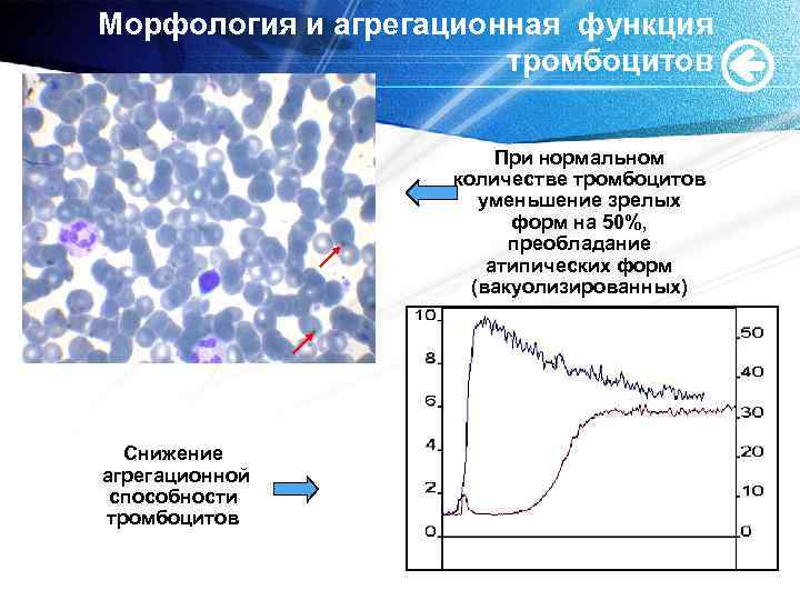 Морфология и агрегационная функция тромбоцитов При нормальном количестве тромбоцитов уменьшение зрелых форм на 50%,