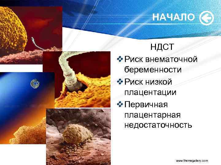 НАЧАЛО НДСТ v Риск внематочной беременности v Риск низкой плацентации v Первичная плацентарная недостаточность