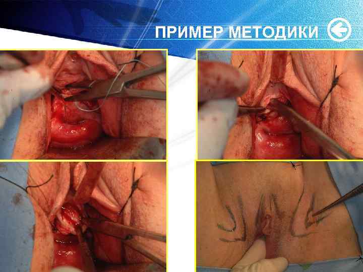 ПРИМЕР МЕТОДИКИ 