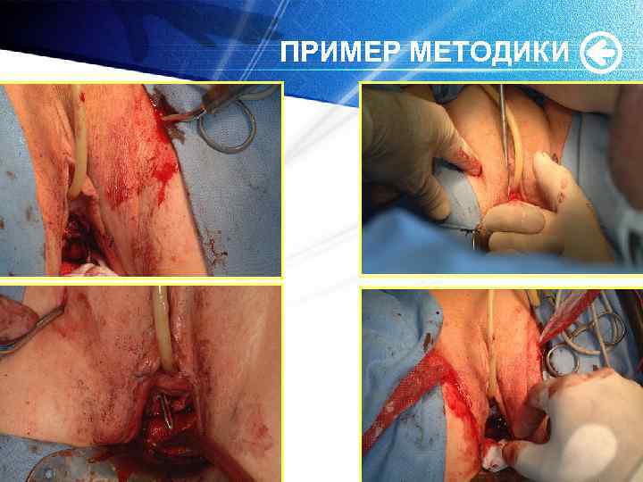 ПРИМЕР МЕТОДИКИ 