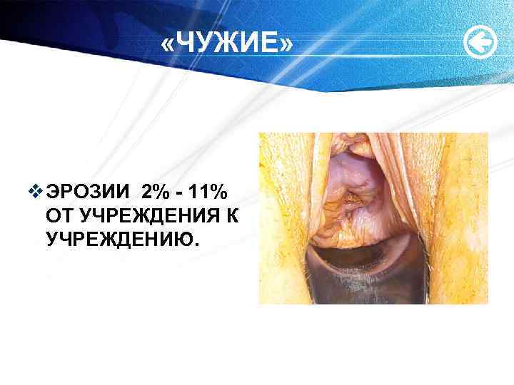  «ЧУЖИЕ» v ЭРОЗИИ 2% - 11% ОТ УЧРЕЖДЕНИЯ К УЧРЕЖДЕНИЮ. 