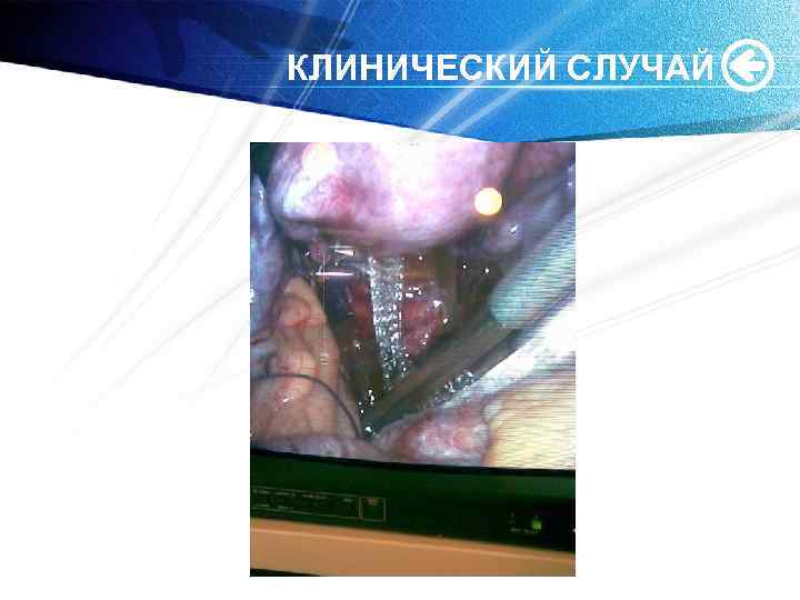 КЛИНИЧЕСКИЙ СЛУЧАЙ 