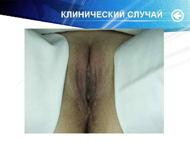 КЛИНИЧЕСКИЙ СЛУЧАЙ 