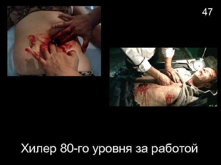 47 Хилер 80 -го уровня за работой 