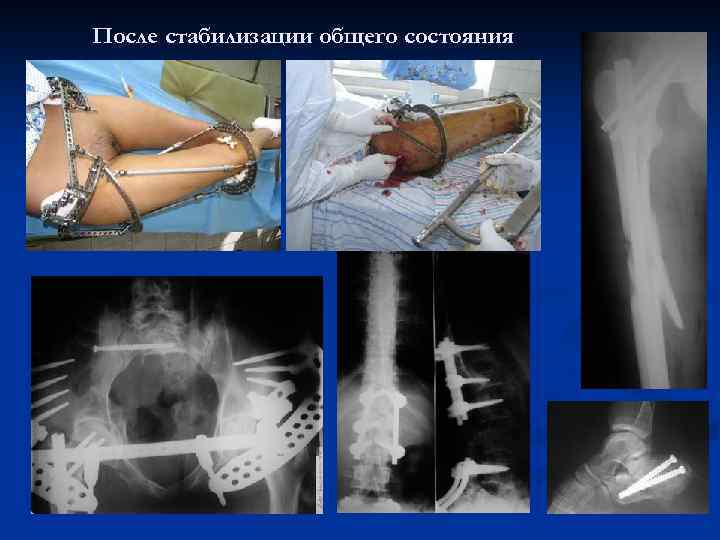 После стабилизации общего состояния 