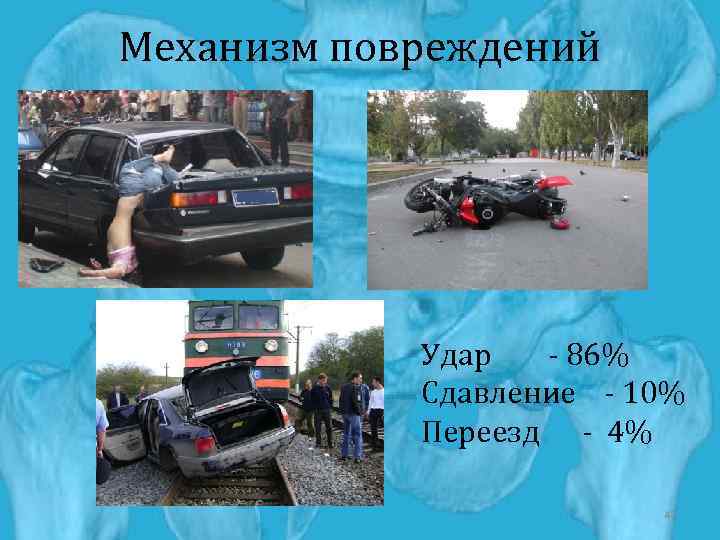 Механизм повреждений Удар - 86% Сдавление - 10% Переезд - 4% 47 