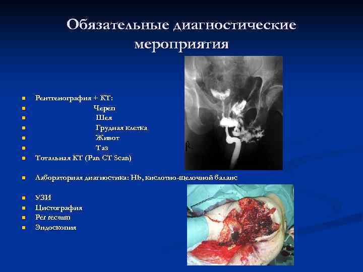 Обязательные диагностические мероприятия n Рентгенография + КТ: Череп Шея Грудная клетка Живот Таз Тотальная