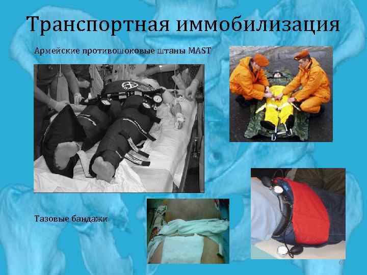 Транспортная иммобилизация Армейские противошоковые штаны MAST Тазовые бандажи 67 