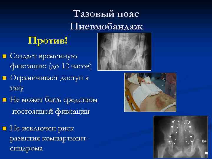 Тазовый пояс Пневмобандаж Против! n n Создает временную фиксацию (до 12 часов) Ограничивает доступ