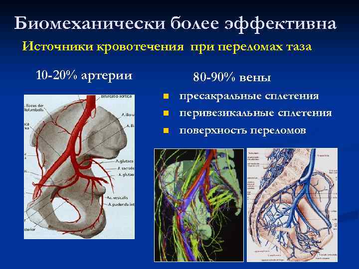 Биомеханически более эффективна Источники кровотечения при переломах таза 10 -20% артерии 80 -90% вены