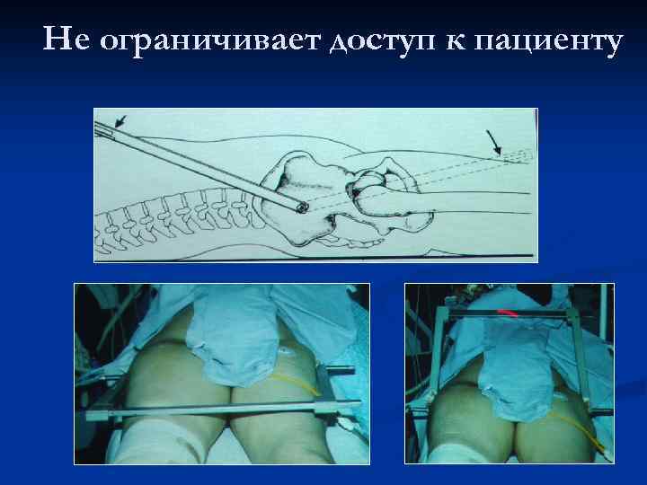 Не ограничивает доступ к пациенту 