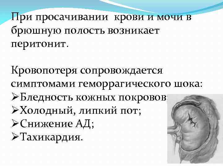 При просачивании крови и мочи в брюшную полость возникает перитонит. Кровопотеря сопровождается симптомами геморрагического