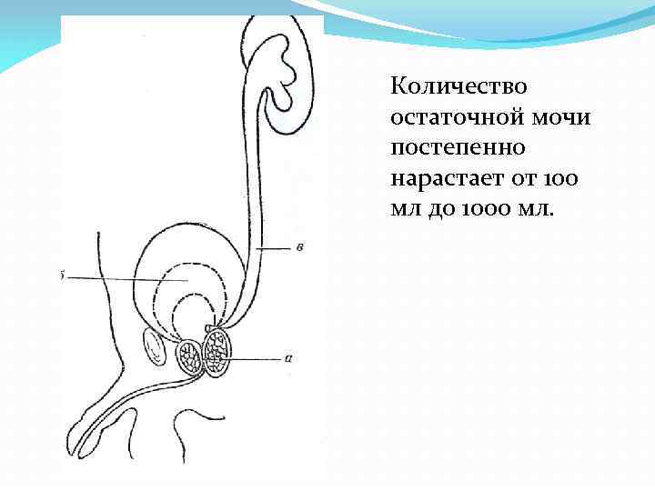 Количество остаточной мочи постепенно нарастает от 100 мл до 1000 мл. 