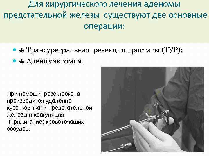 Для хирургического лечения аденомы предстательной железы существуют две основные операции: Трансуретральная резекция простаты (ТУР);