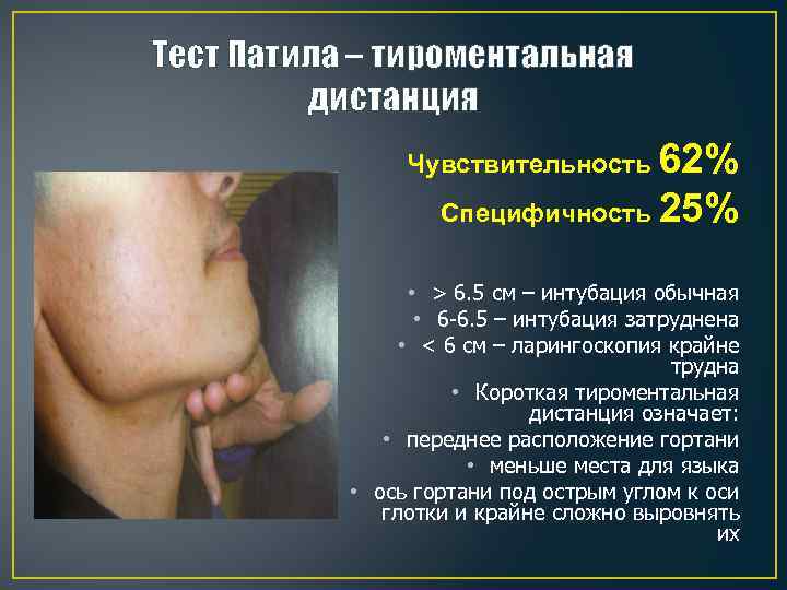 Тест Патила – тироментальная дистанция Чувствительность 62% Специфичность 25% • > 6. 5 см