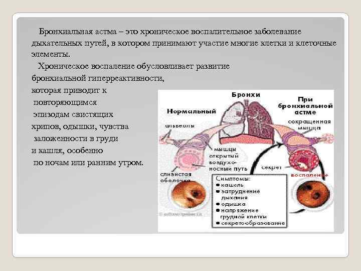  Бронхиальная астма – это хроническое воспалительное заболевание дыхательных путей, в котором принимают участие