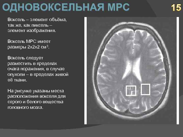 ОДНОВОКСЕЛЬНАЯ МРС Воксель – элемент объёма, так же, как пиксель – элемент изображения. Воксель