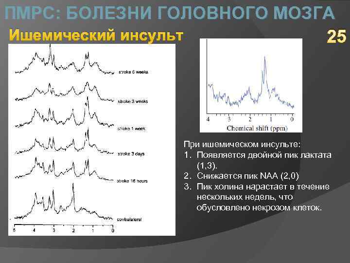 ПМРС: БОЛЕЗНИ ГОЛОВНОГО МОЗГА Ишемический инсульт 25 При ишемическом инсульте: 1. Появляется двойной пик