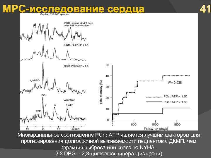 МРС-исследование сердца 41 Миокардиальное соотношение PCr : ATP является лучшим фактором для прогнозирования долгосрочной